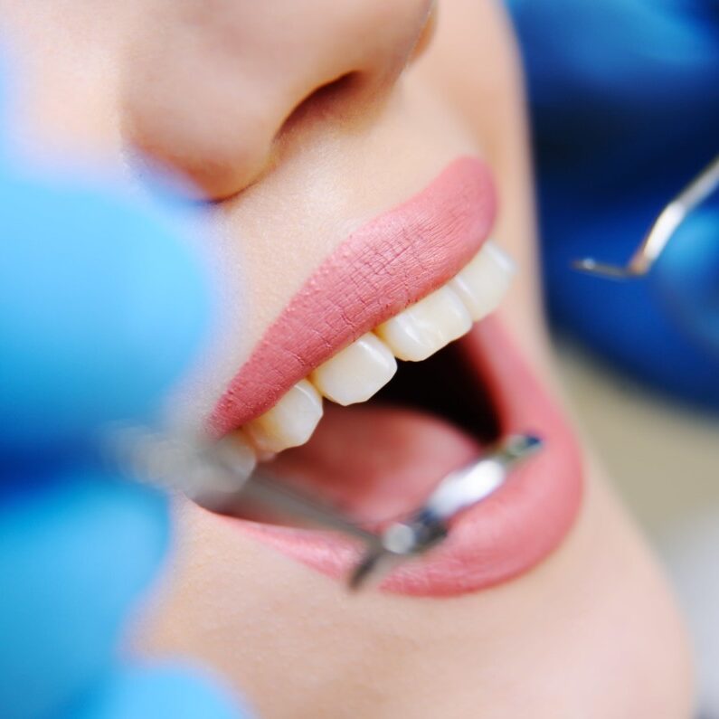 beautiful-girl-dental-chair-examination-dentist-min