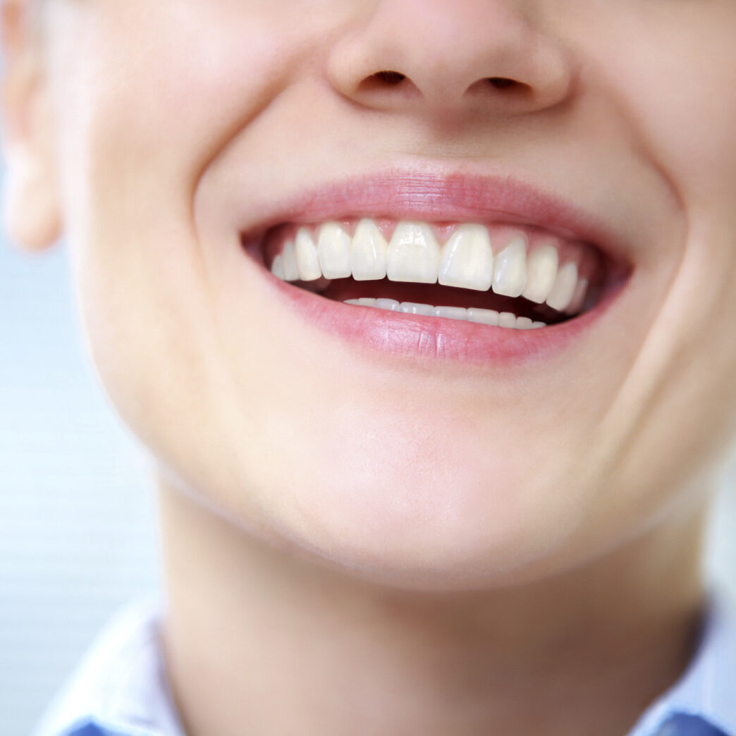 Close-up of female smile with healthy teeth